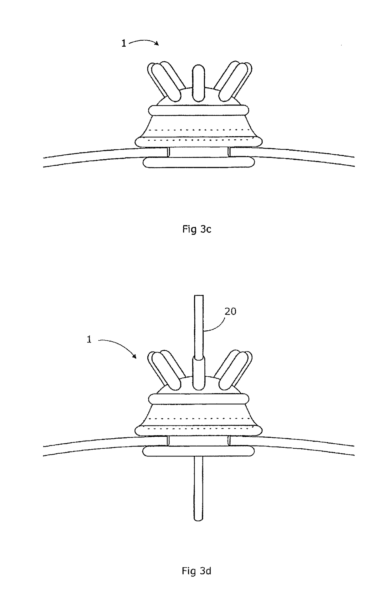 Surgical device