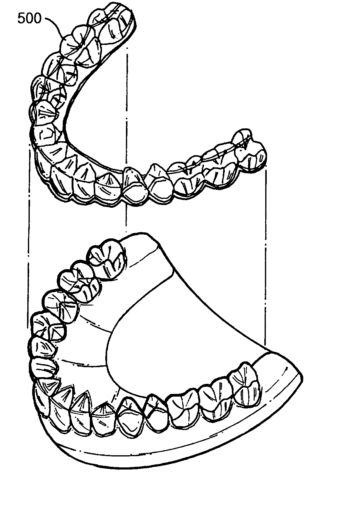 Orthodontic appliance by using a shape memory polymer
