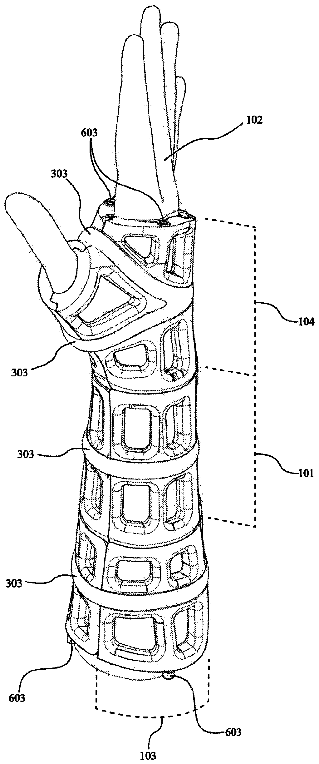 Adaptive three-dimensional orthosis and manufacturing method thereof