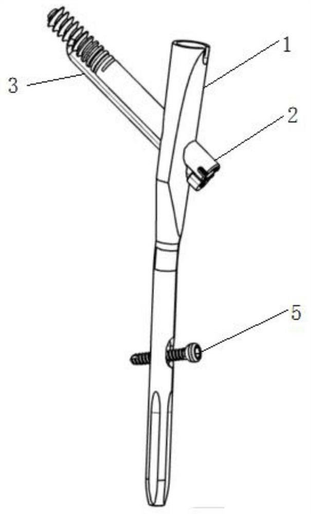 Intramedullary implantation system