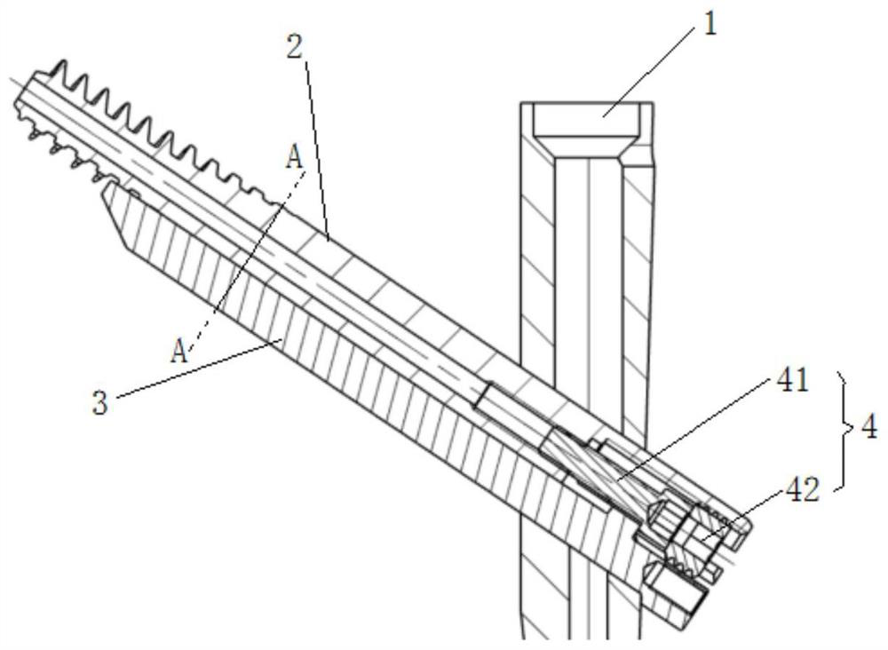 Intramedullary implantation system