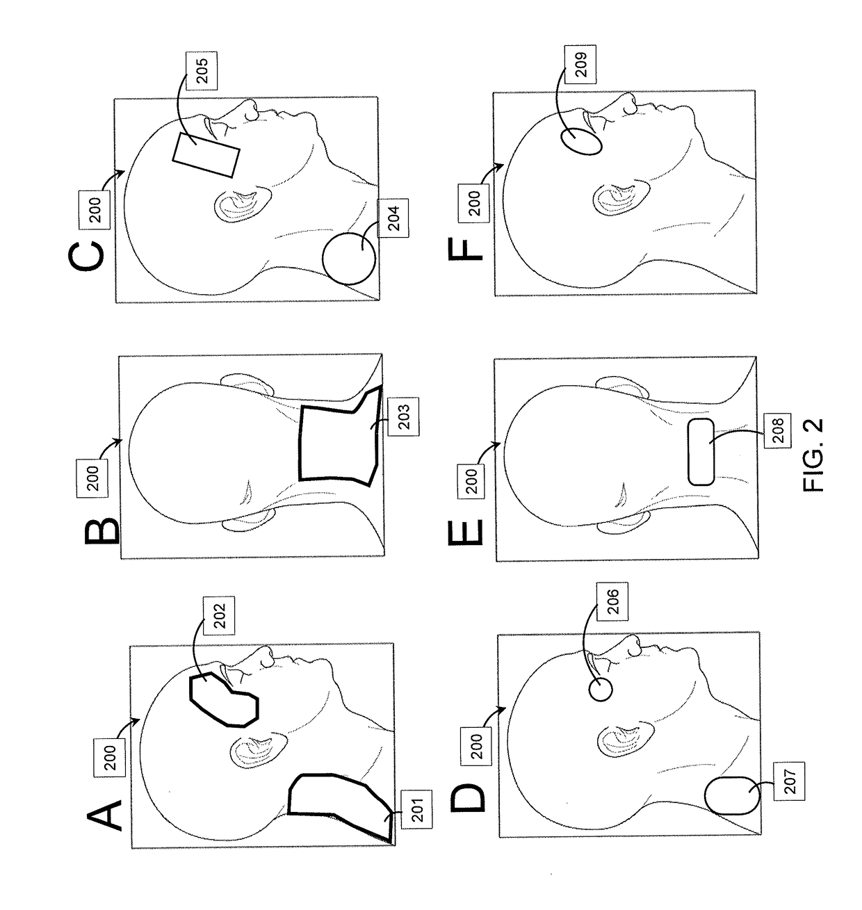 Systems and methods for transdermal electrical stimulation to improve sleep