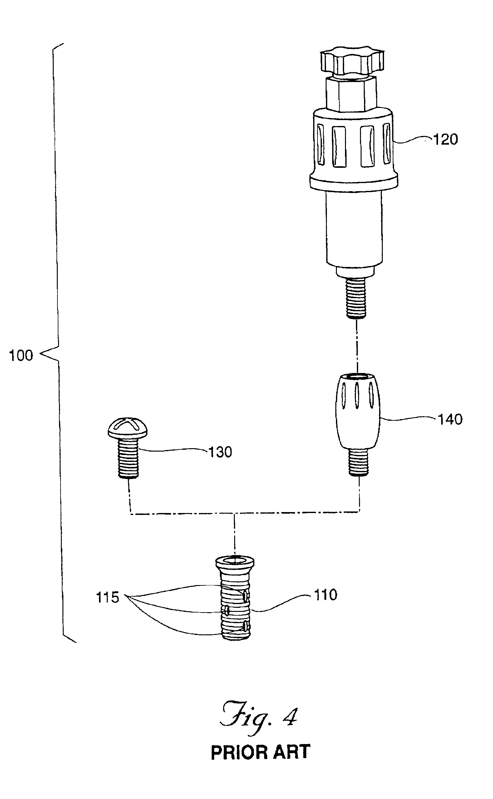 Expandable polymer dental implant and method of use