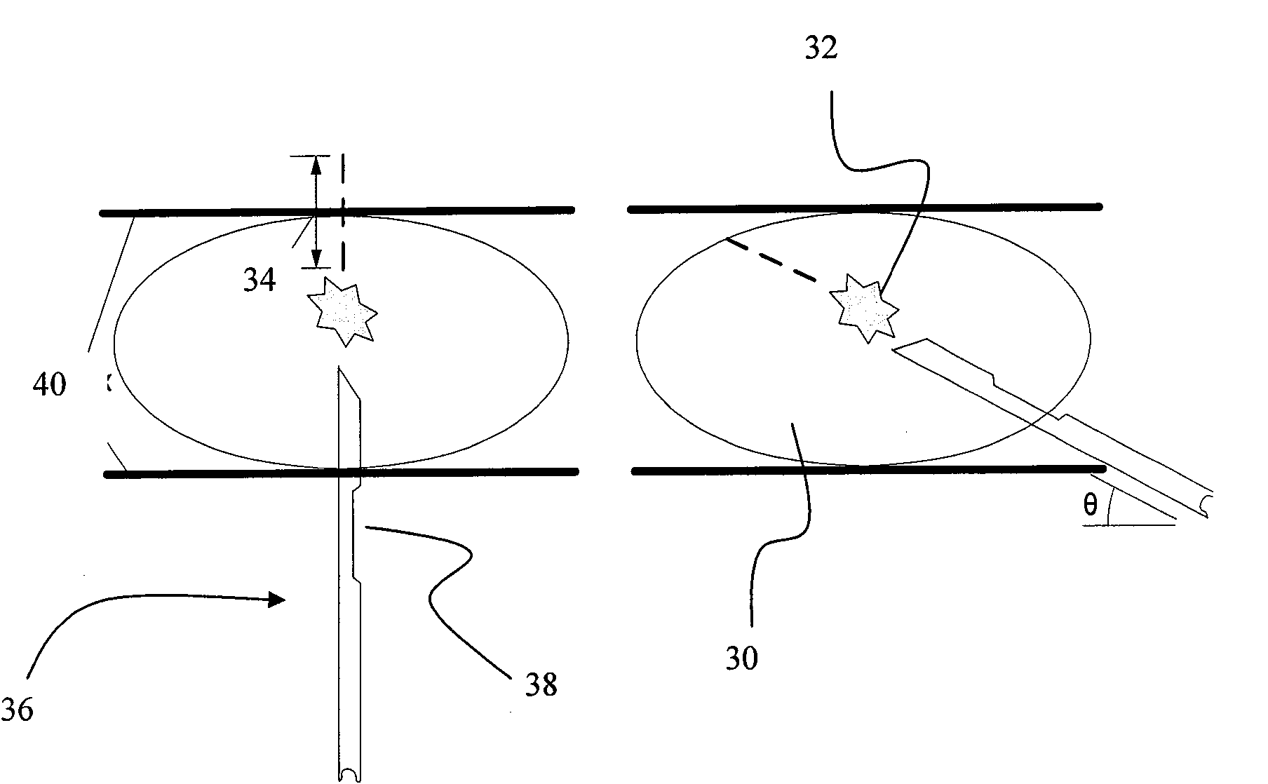 Methods and apparatus of cone beam ct imaging and image-guided procedures