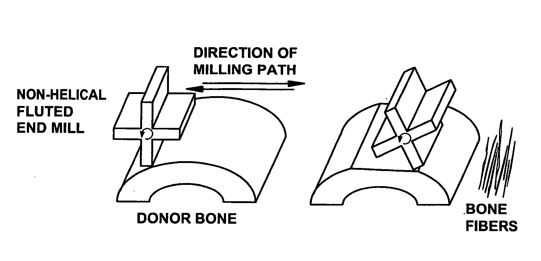 Tissue-derived mesh for orthopedic regeneration