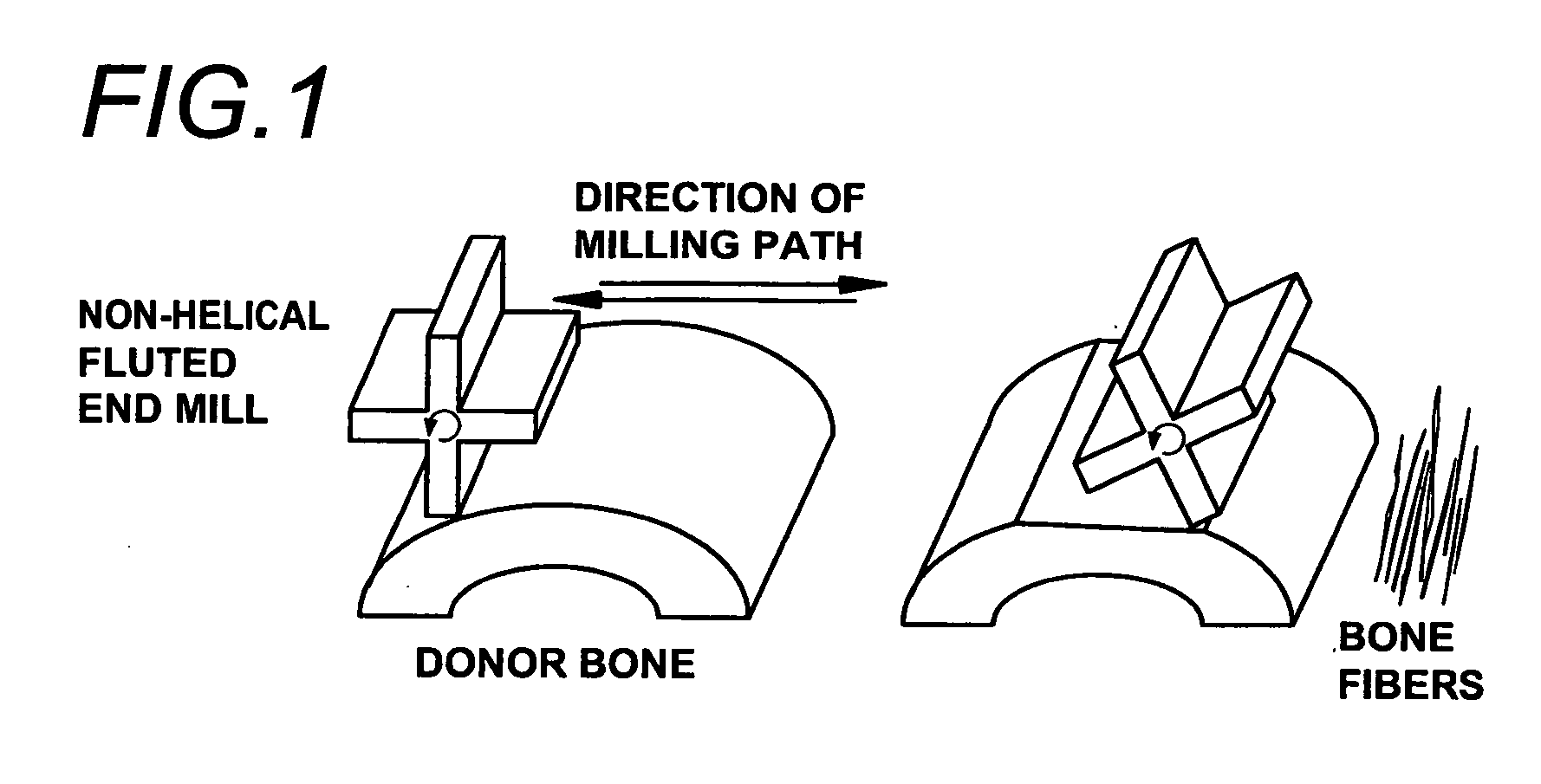 Tissue-derived mesh for orthopedic regeneration