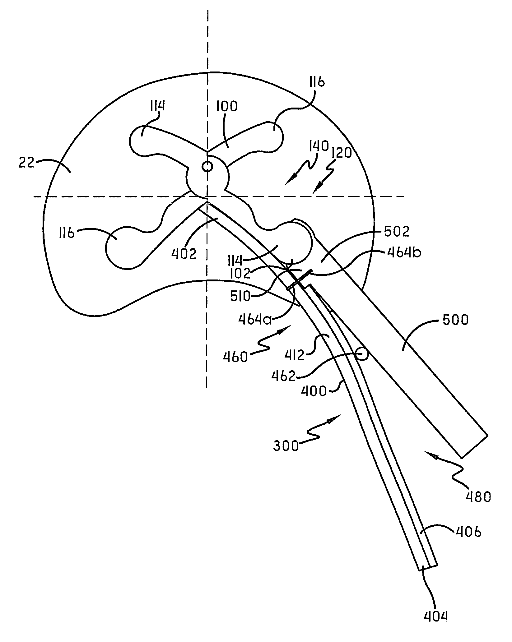 Spine surgery method and instrumentation