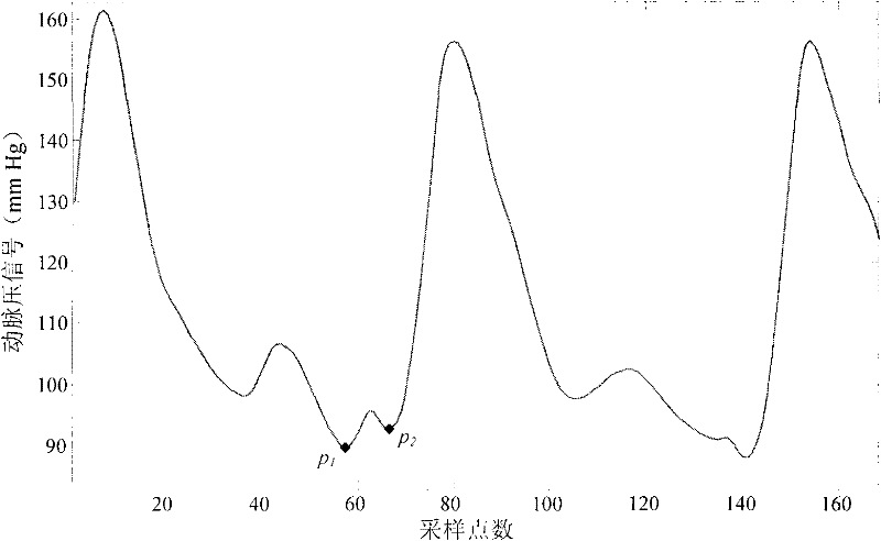 Method for segmenting arterial pressure signal by beats