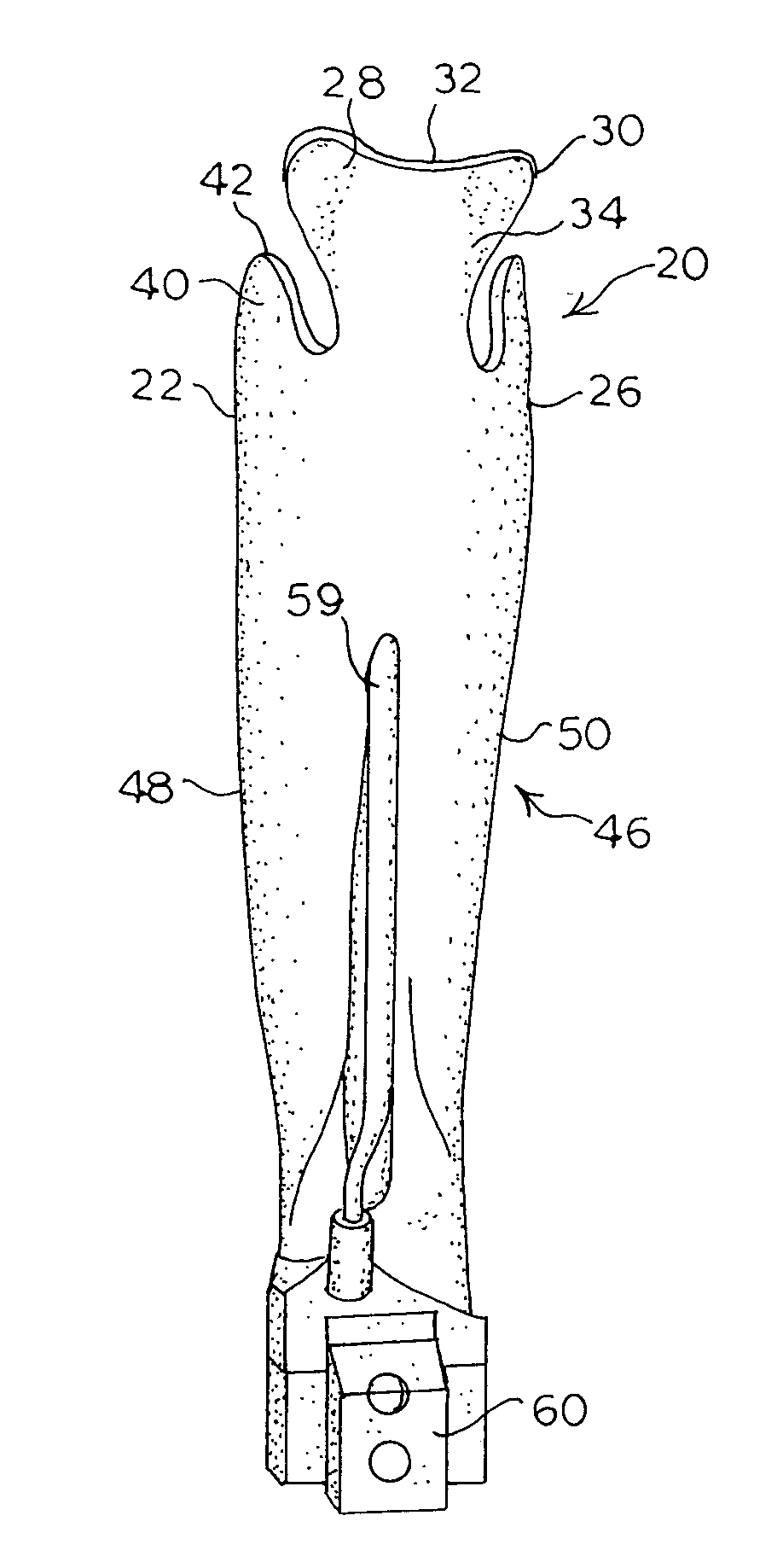 Laryngoscope blade
