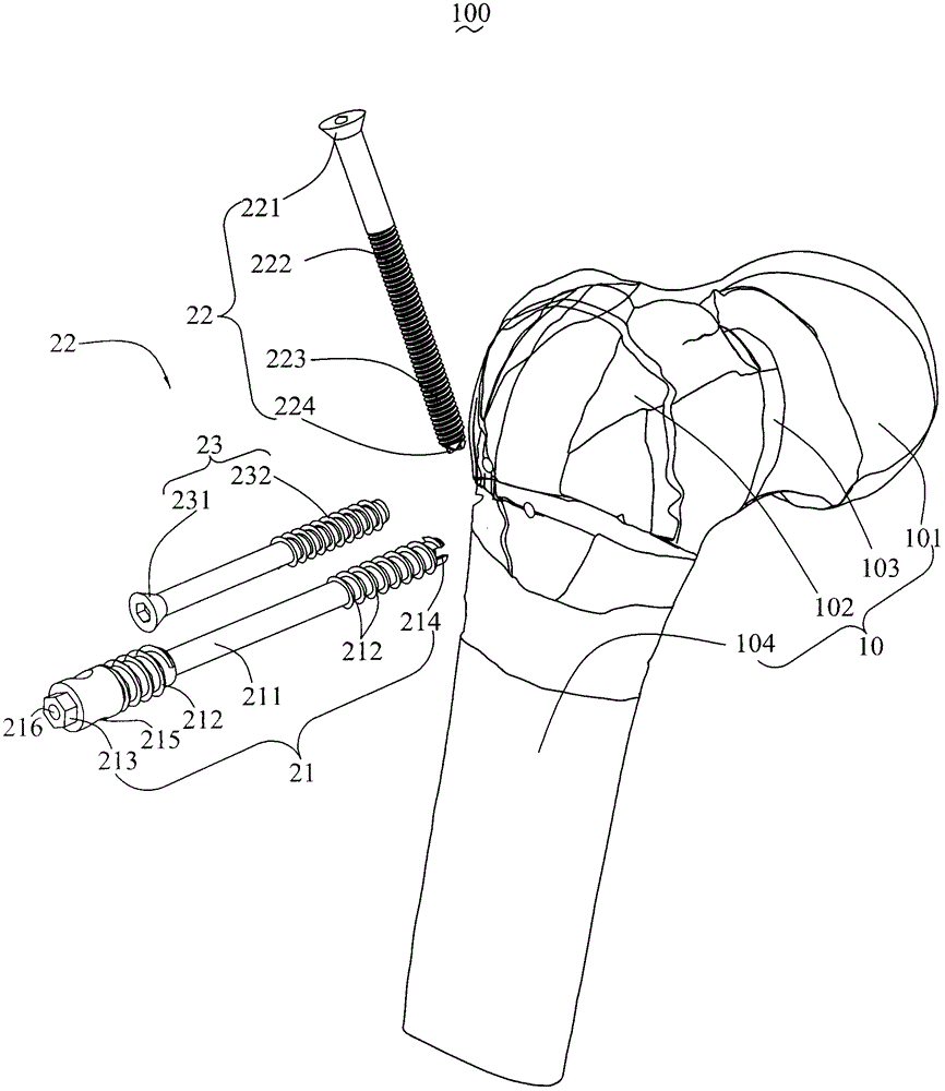 Femoral neck fixing mechanism and femoral neck fracture fixing structure thereof