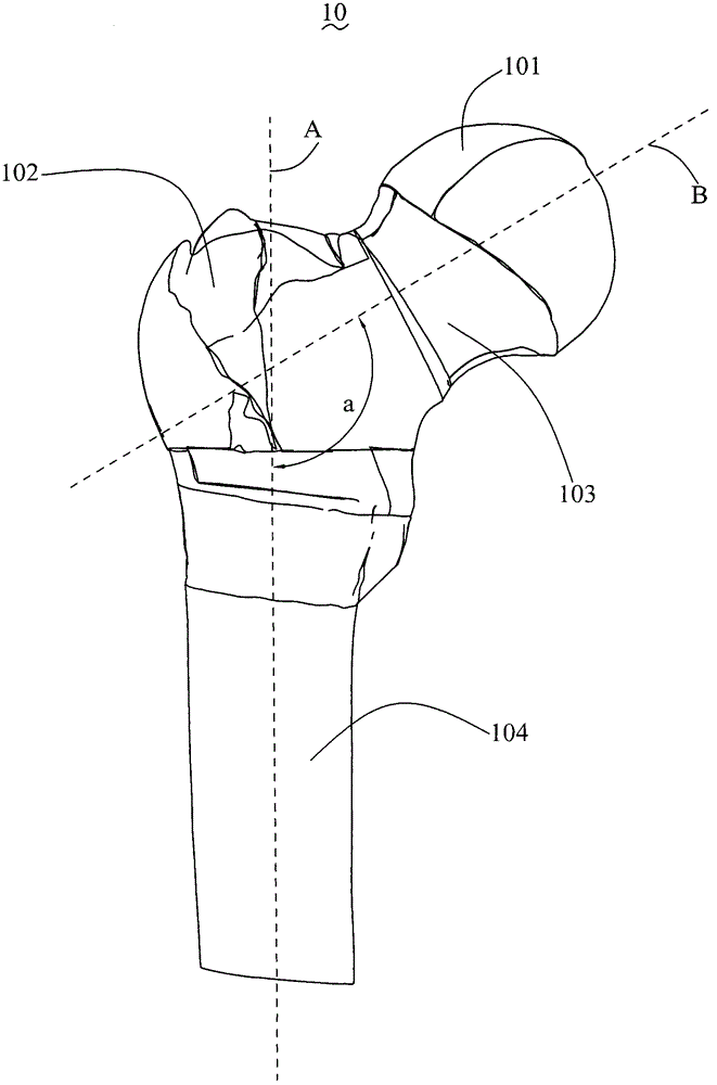 Femoral neck fixing mechanism and femoral neck fracture fixing structure thereof