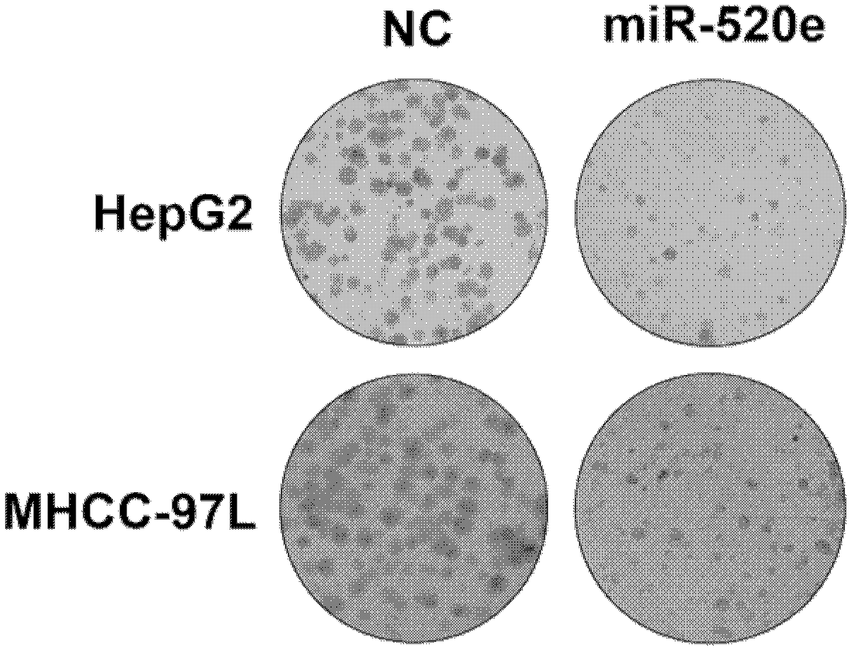 Antitumor application of has-miR-520e