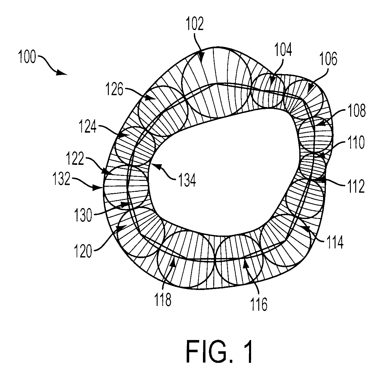Method and system for segmentation of tubular structures using pearl strings