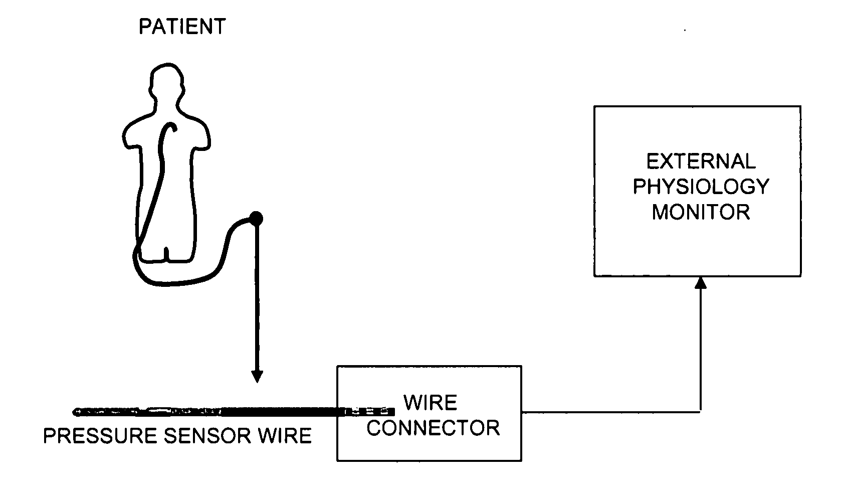 Pressure wire assembly