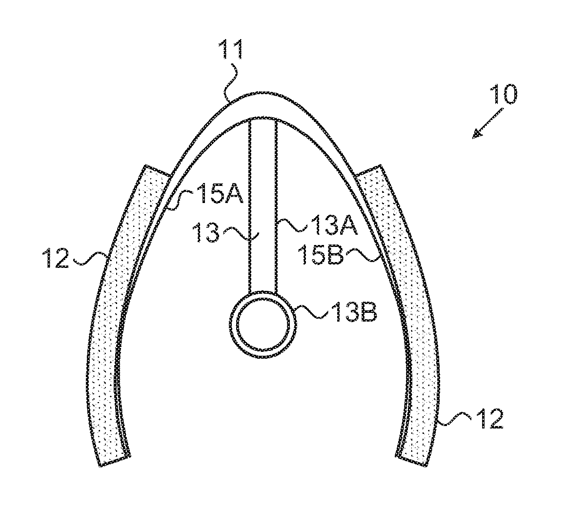 Anal fixation device