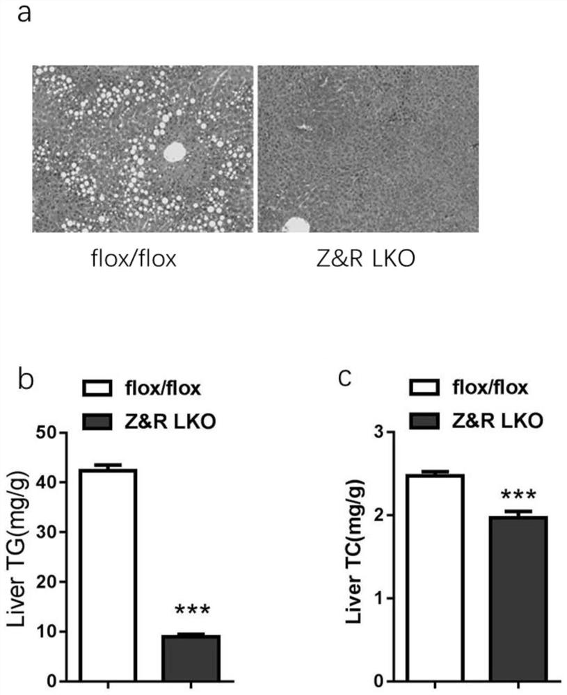 Application of ZNRF3/RNF43 in preparation of medicine for regulating energy metabolism