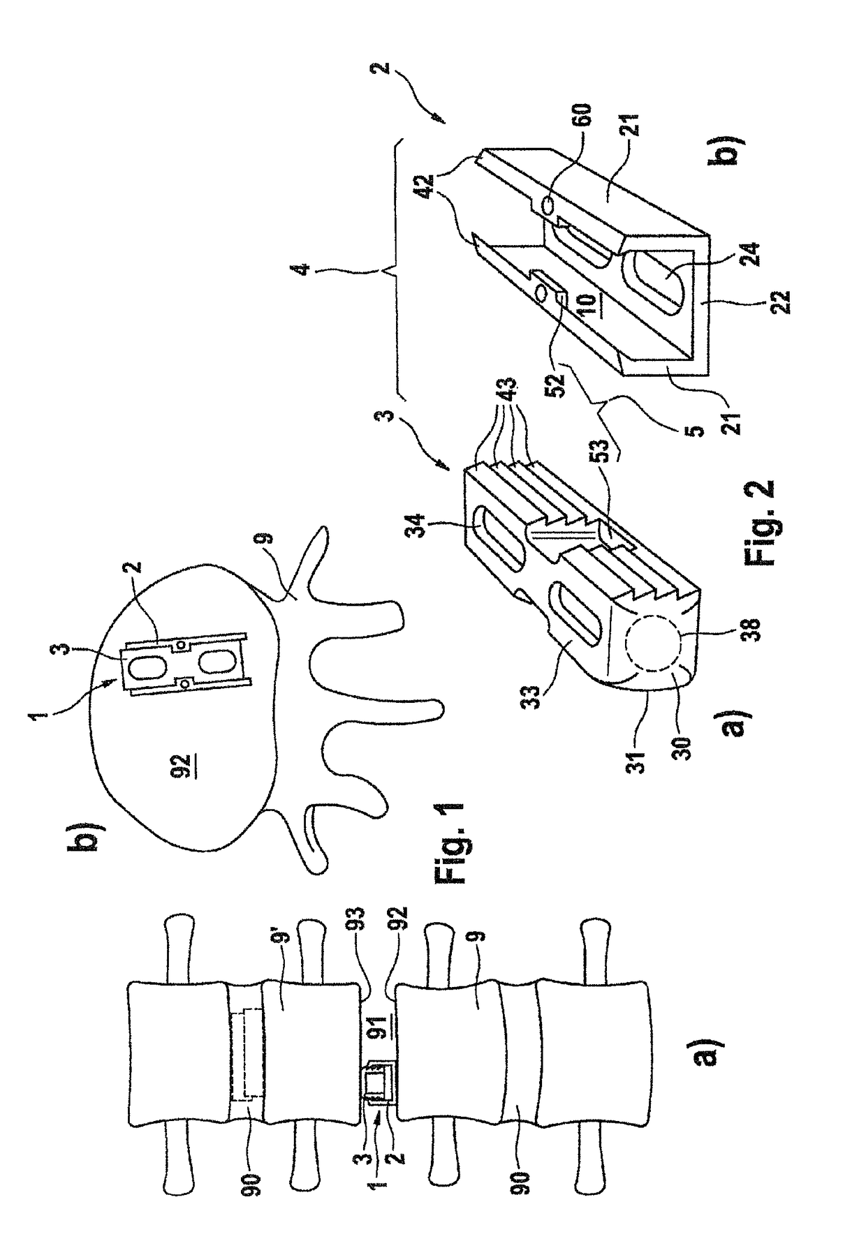 Intervertebral cage which is expandable in steps and implantation instrument therefor