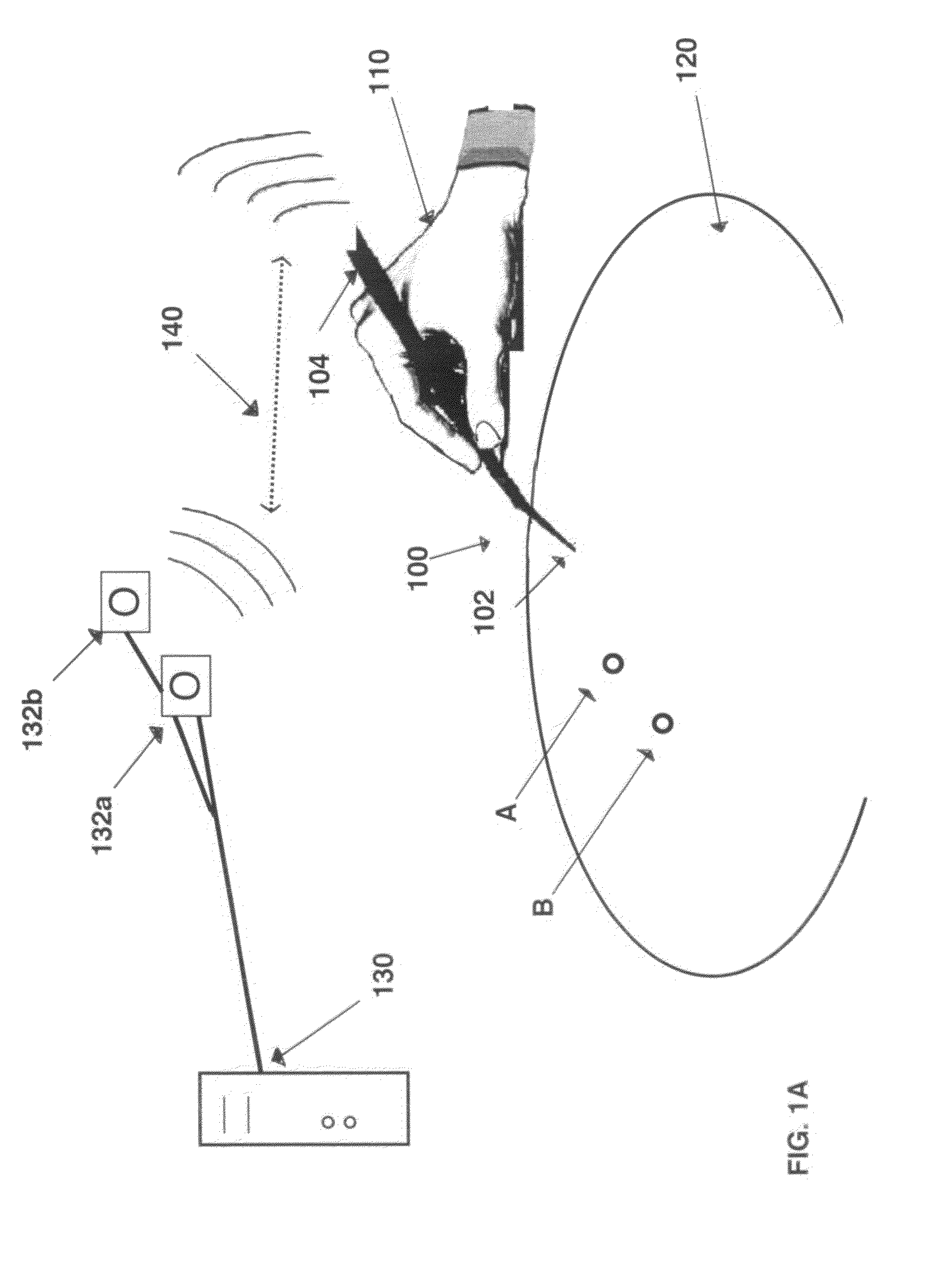 Device and method for measuring anatomic geometries