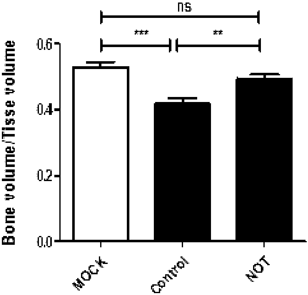 Small molecule compound for treating rheumatoid arthritis and application thereof