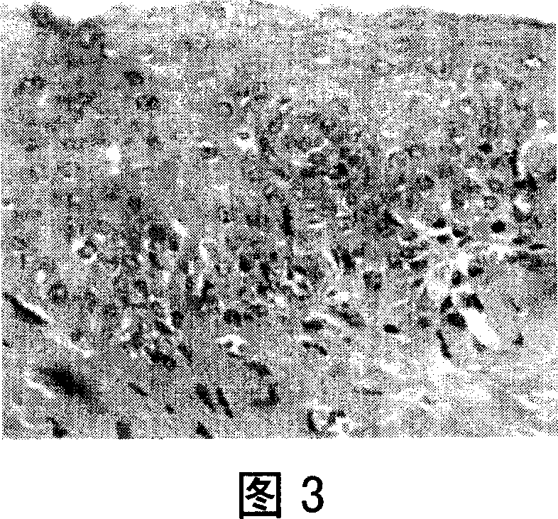 Method of thalidomide for effective interventing oral cancer in animal model