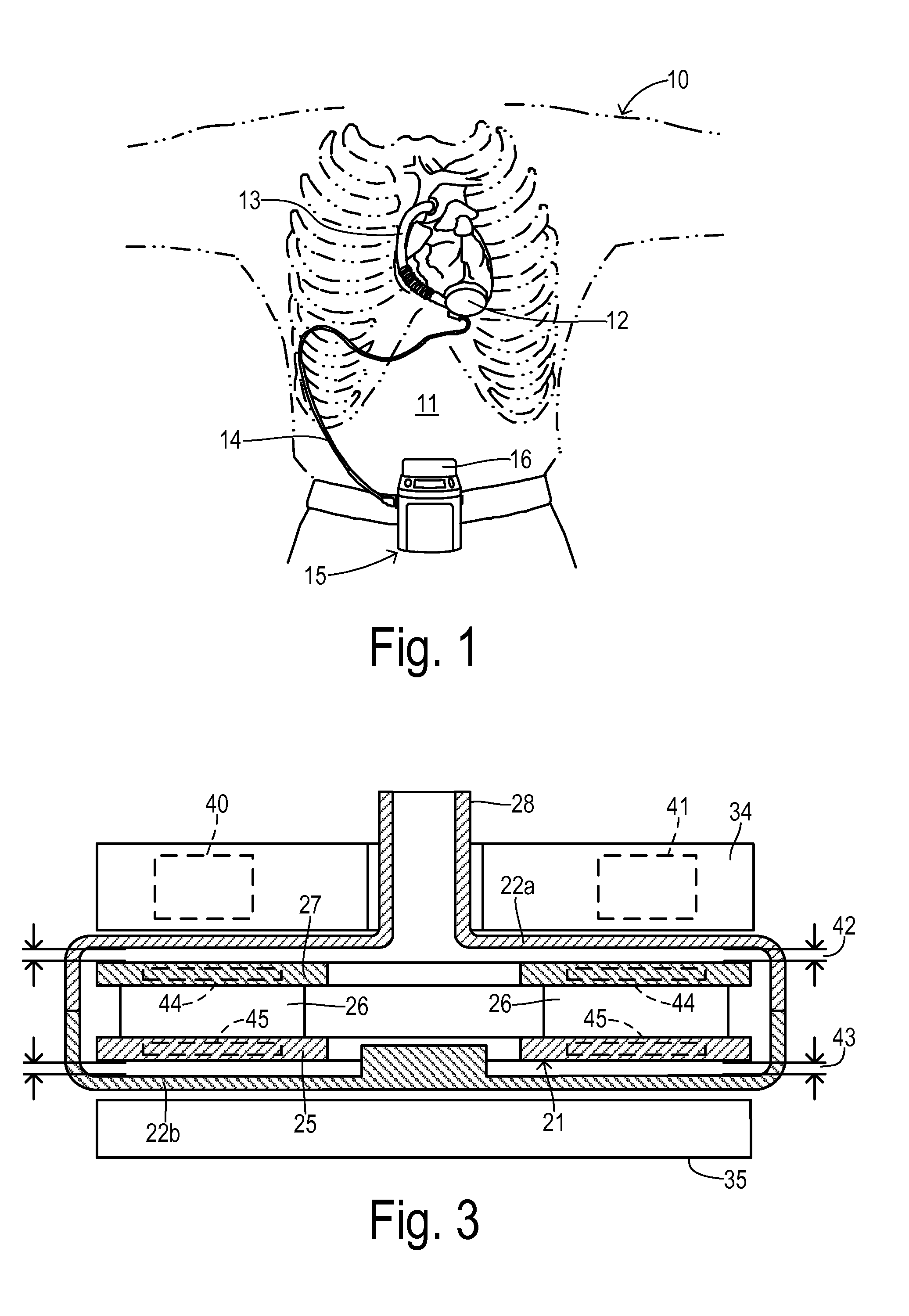 Impeller position compensation using field oriented control