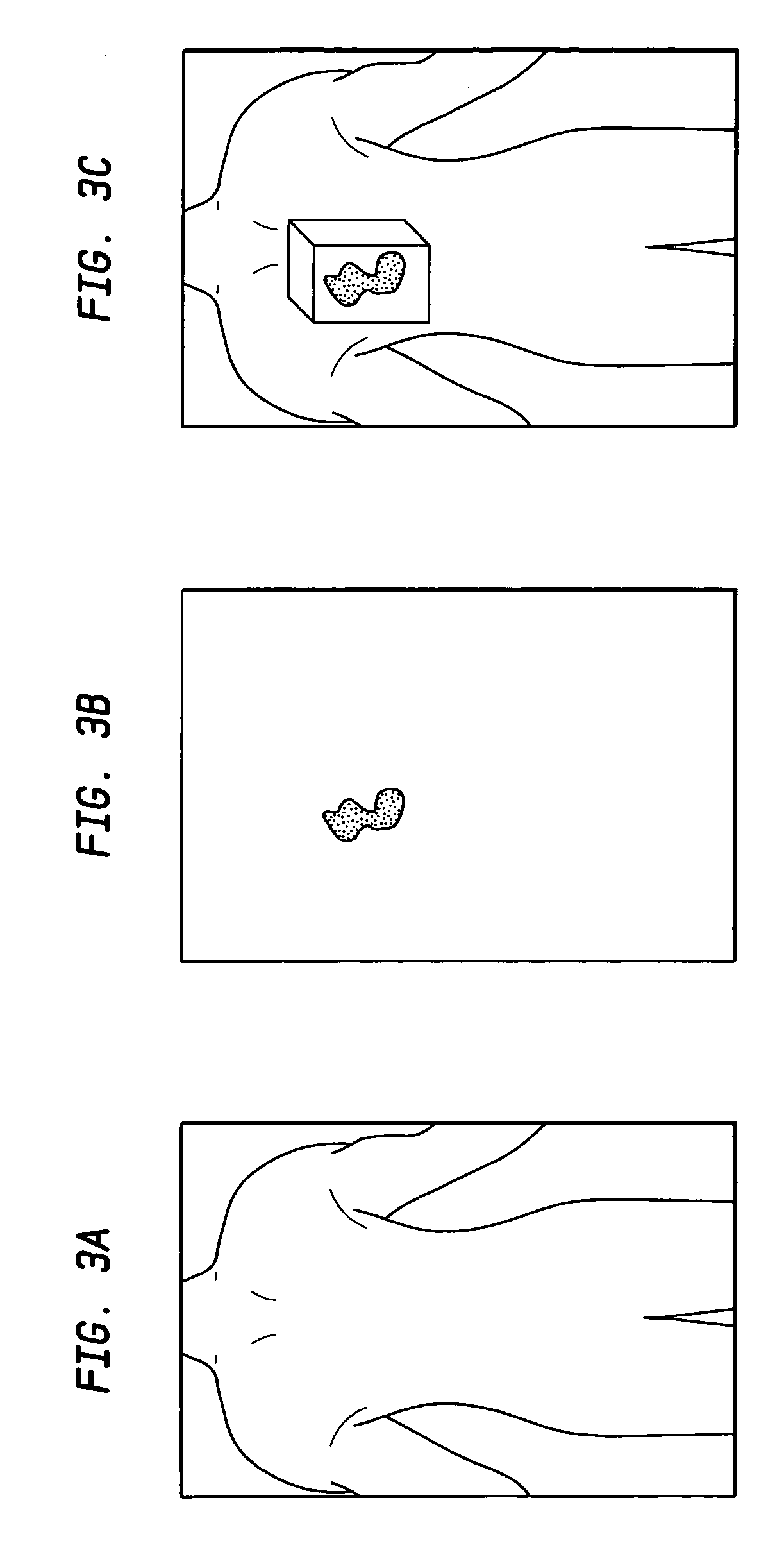 System and method of measuring disease severity of a patient before, during and after treatment