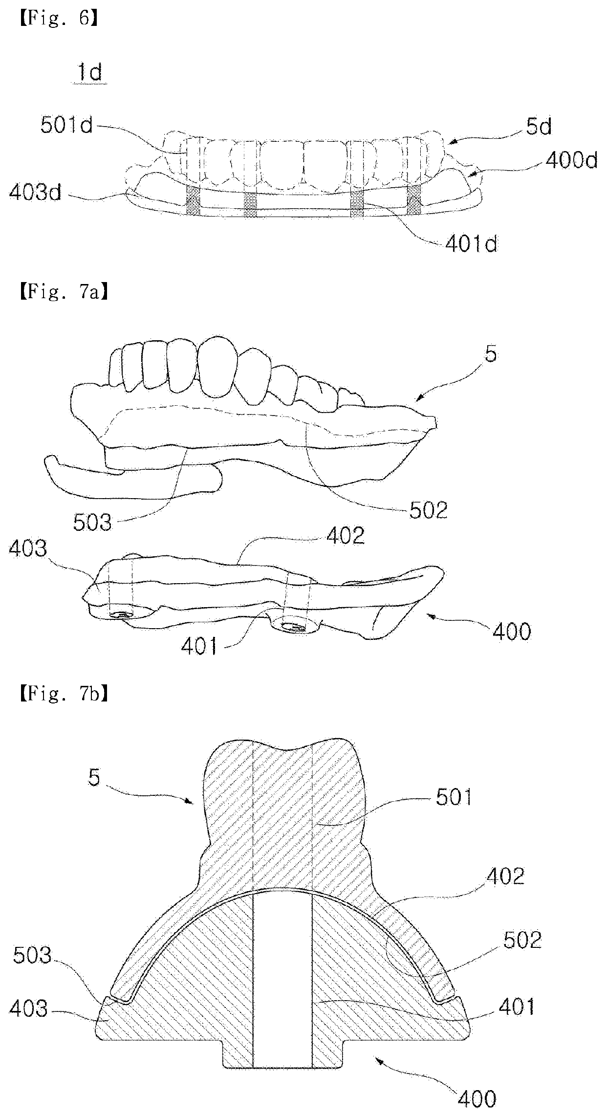 Digital denture manufacturing method and manufacturing system, and denture hole guider applied thereto and manufacturing method thereof