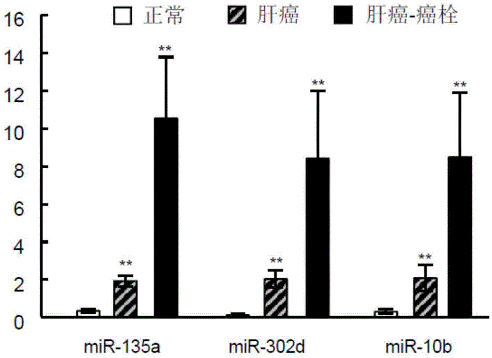 Hsa-mir-135a, hsa-mir-302d and hsa-mir-10b joint detection kit for detecting liver cancer genesis or metastasis early