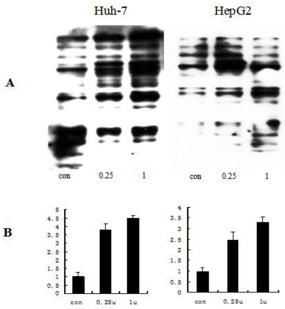 Application of beta-1, 4-galactosyltransferase-IsiRNA in drugs for overcoming liver cancer chemotherapy drug resistance