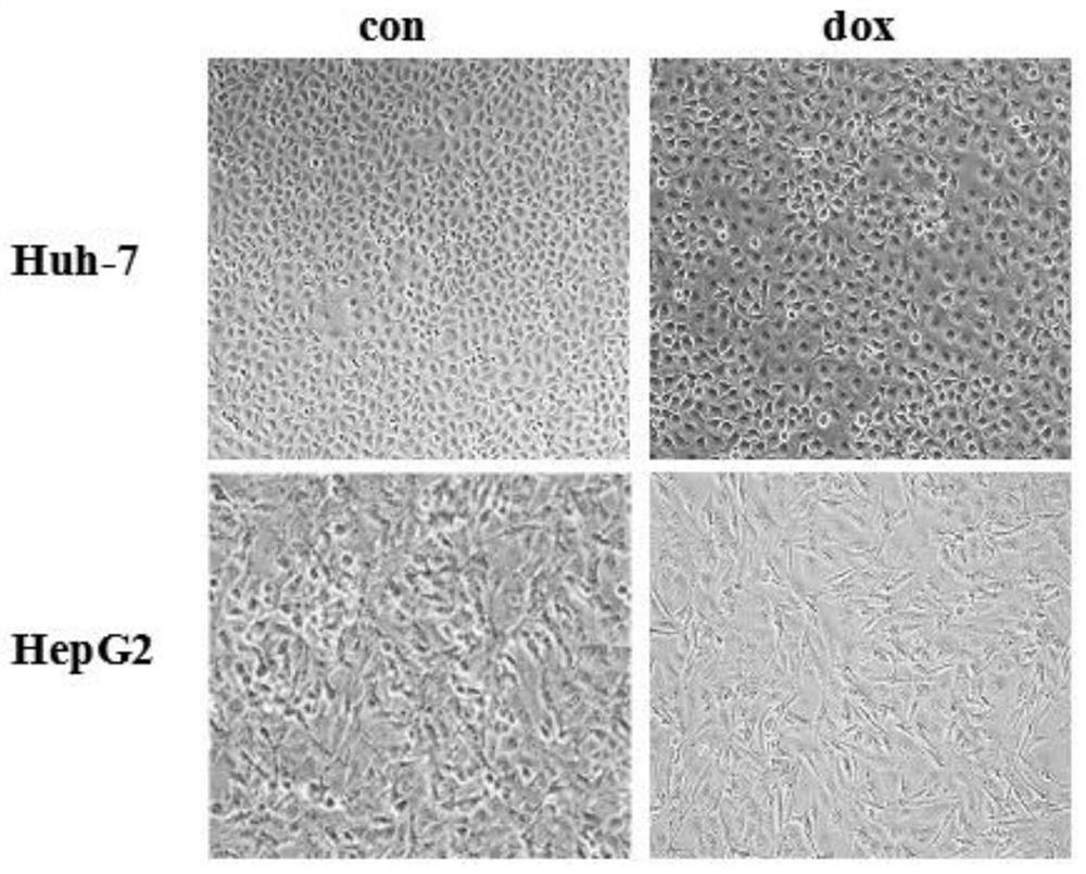 Application of beta-1, 4-galactosyltransferase-IsiRNA in drugs for overcoming liver cancer chemotherapy drug resistance