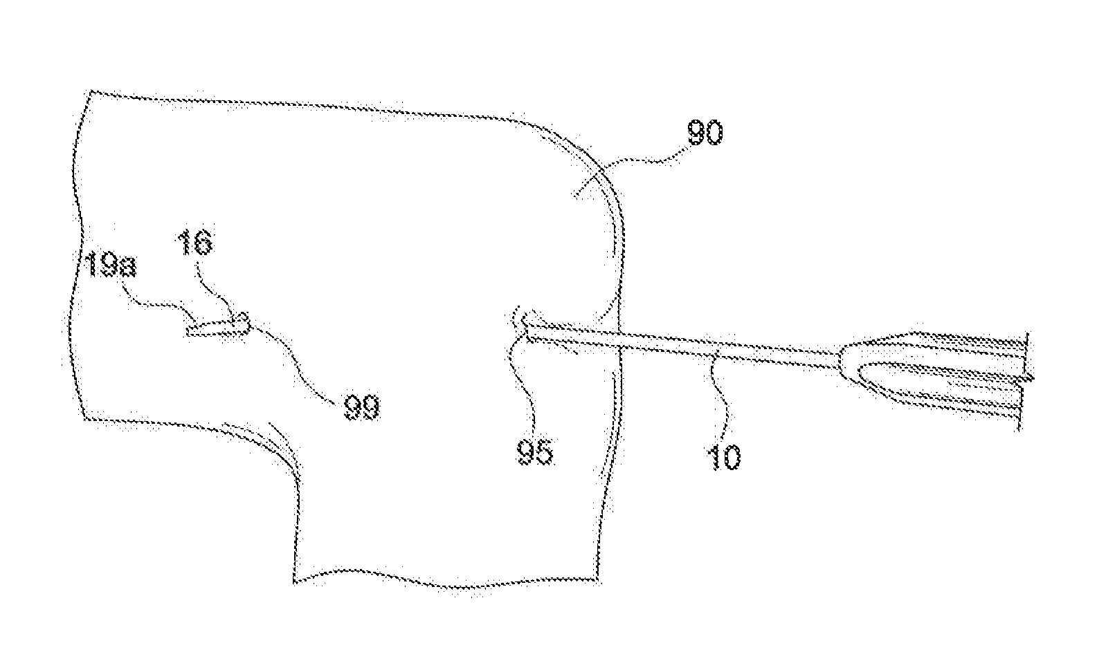 Methods and instruments for forming a posterior knee portal and for inserting a cannula