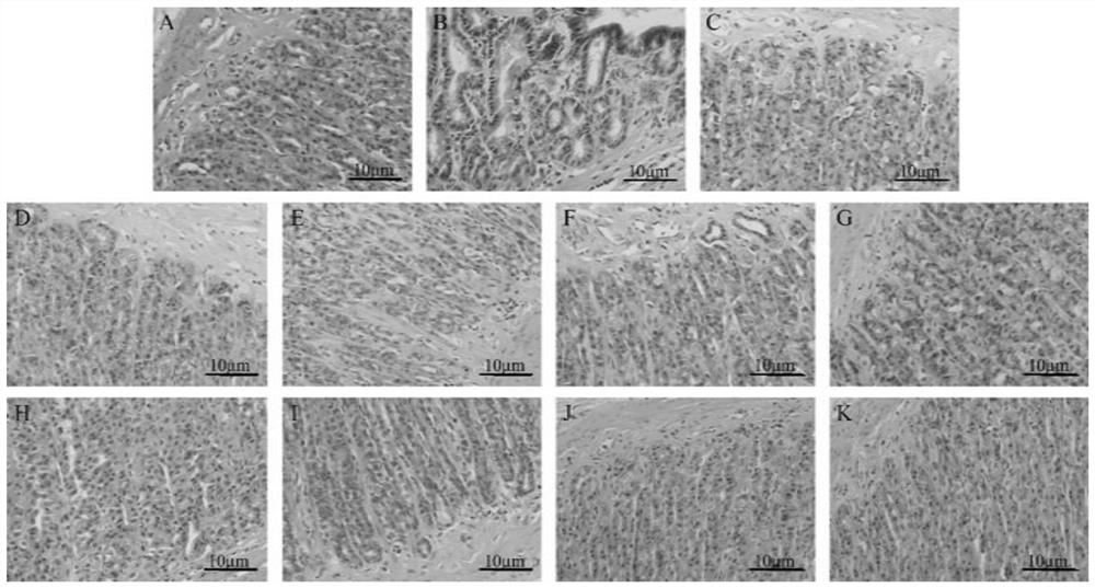 Oligosaccharide composition extracted from traditional Chinese medicines as well as preparation method and application of oligosaccharide composition