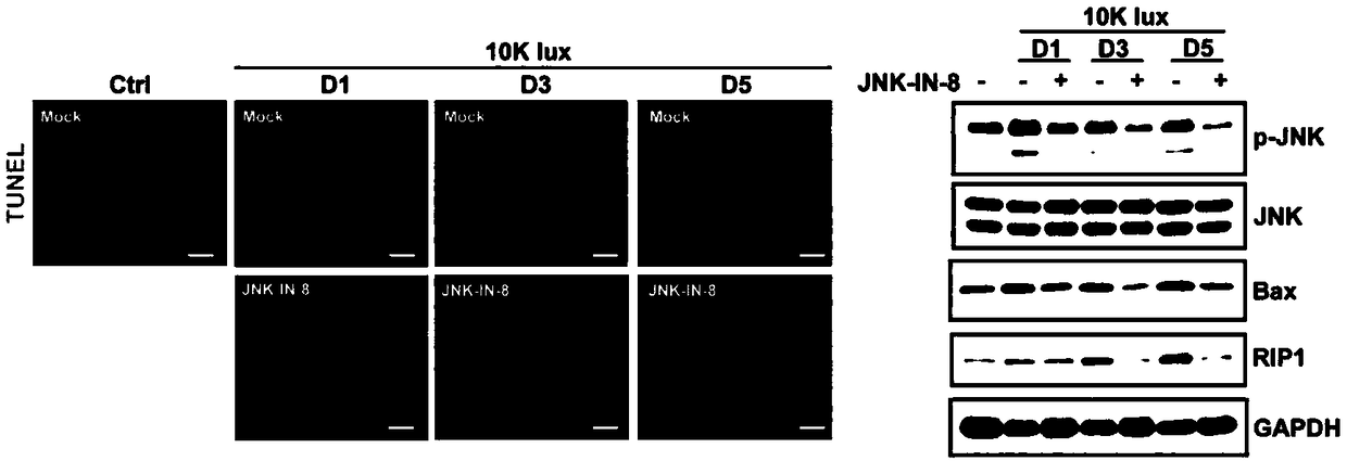 Application of JNK-IN-8 for preparing neuroprotective agent for dry age-related macular degeneration (AMD)