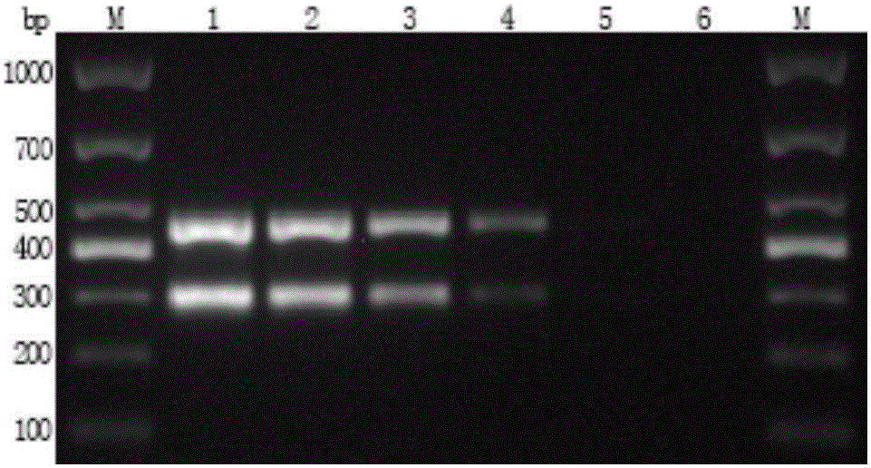 Multi-DPO-PCR primer composition for detecting vibrio parahaemolyticus and vibrio cholerae