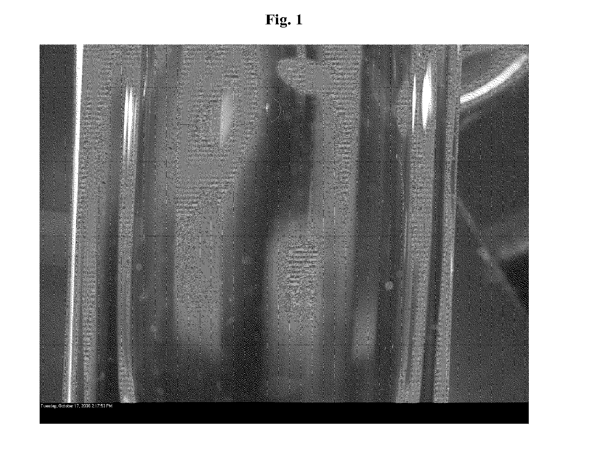Compositions comprising deoxycholic acid and salts thereof suitable for use in treating fat deposits