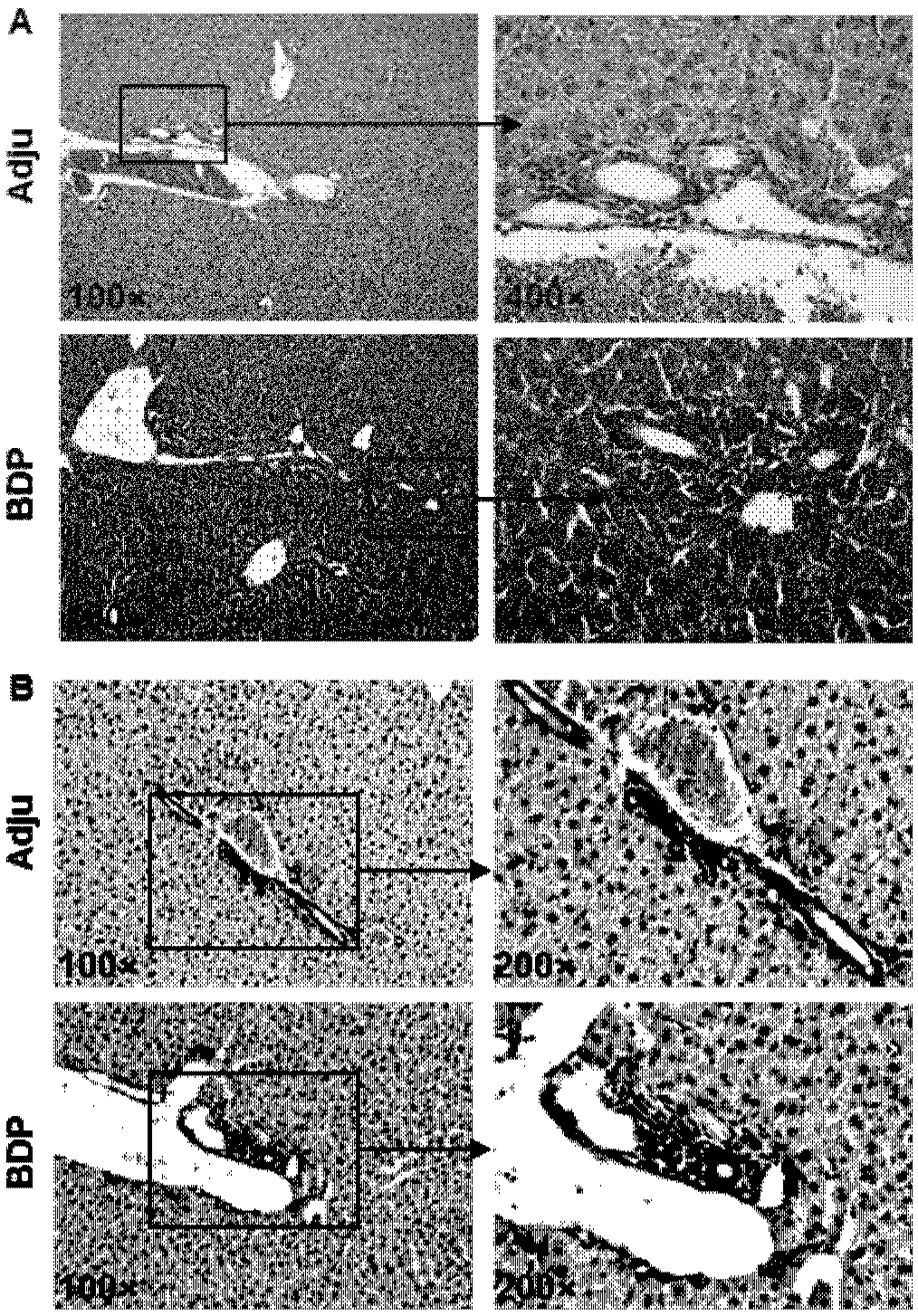 Breeding method for establishing primary biliary cholangitis model mouse through bile duct antigen immunity