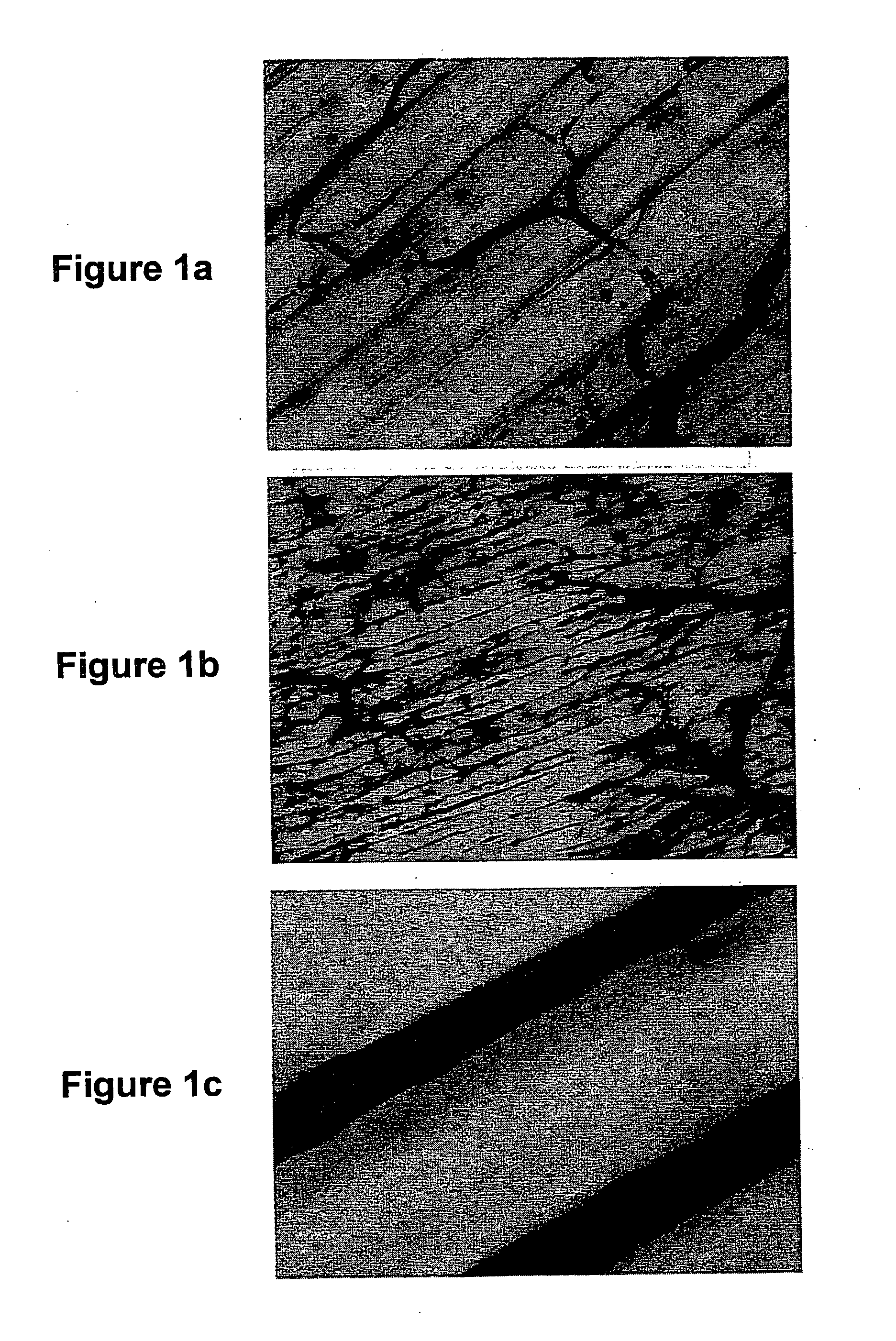 Compositions, kits, methods, and apparatus for transvascular delivery of a composition to an extravascular tissue of a mammal