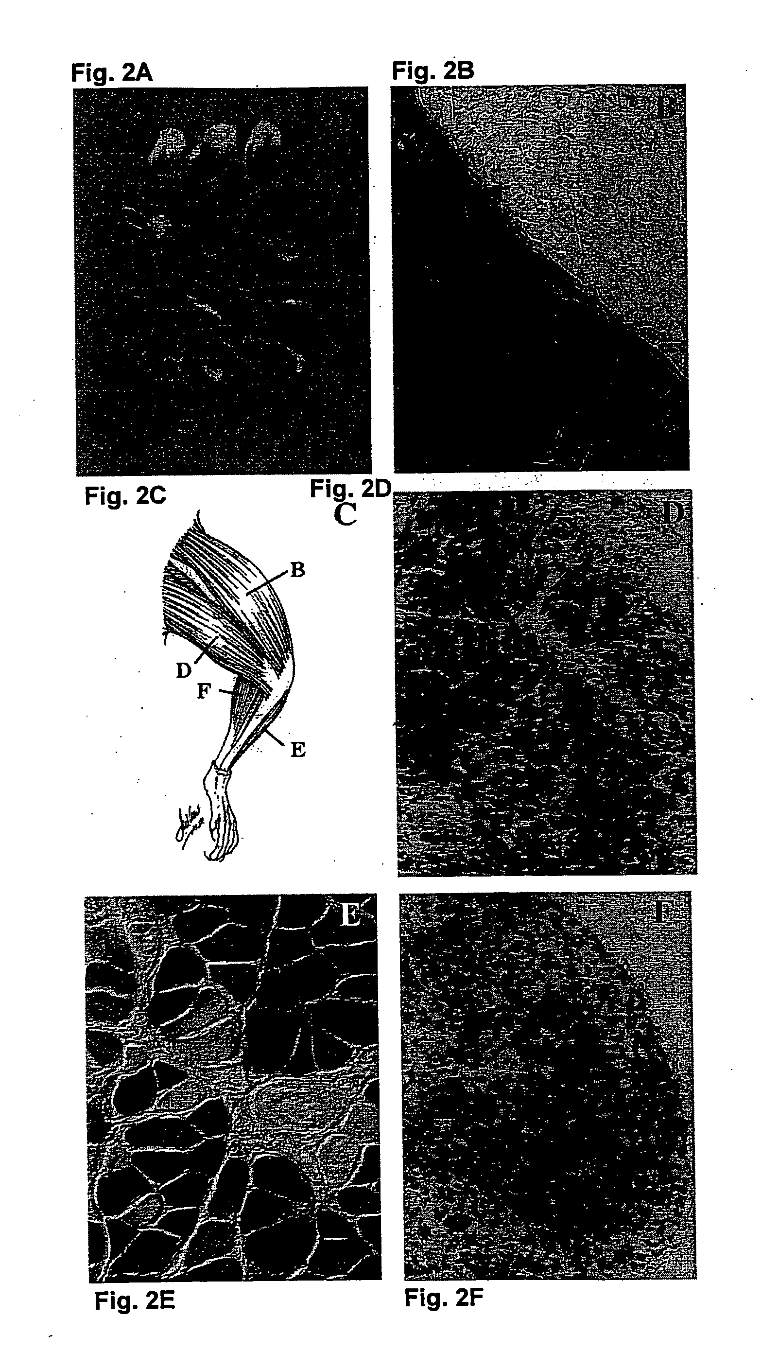 Compositions, kits, methods, and apparatus for transvascular delivery of a composition to an extravascular tissue of a mammal