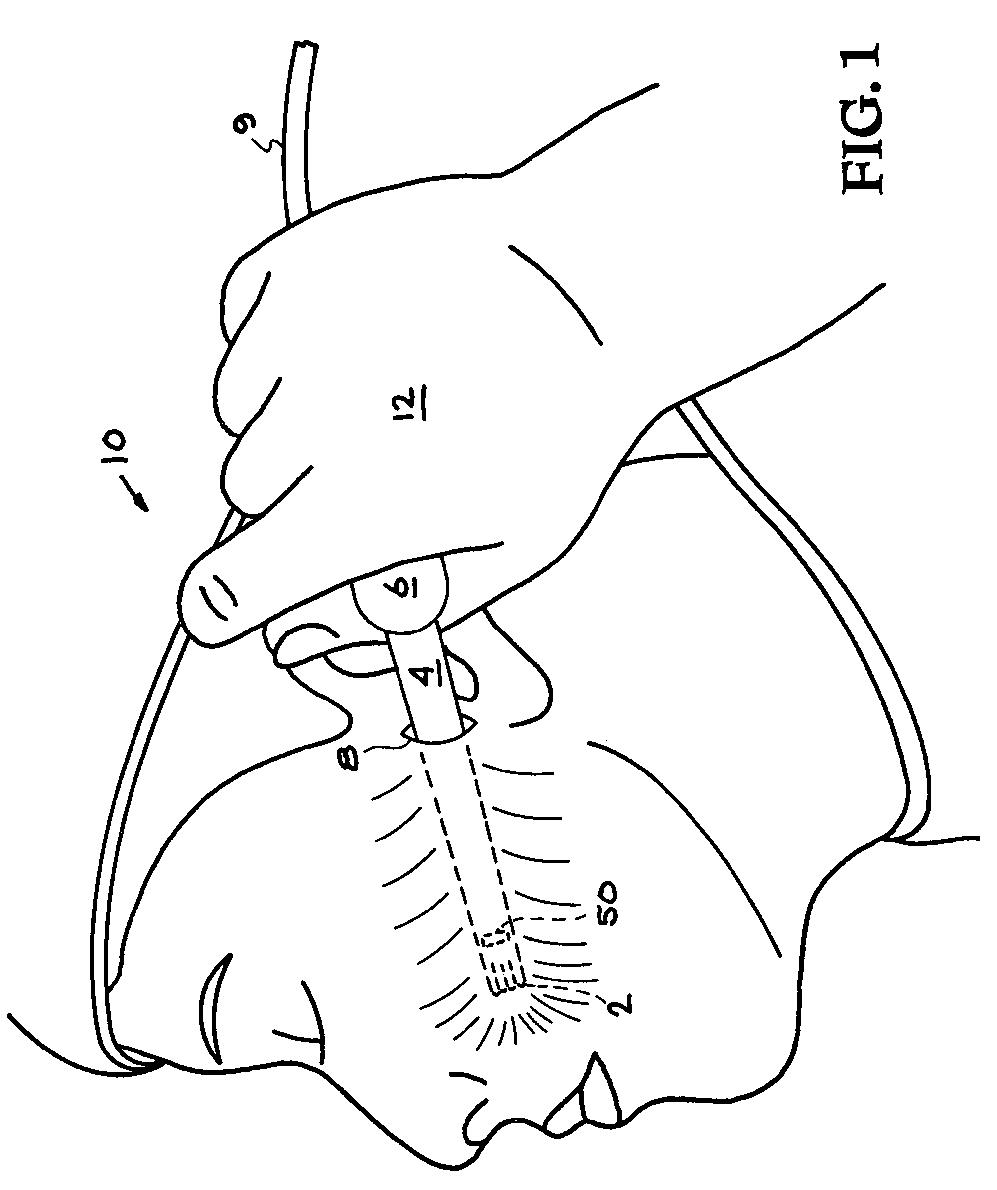 Face-lifting device