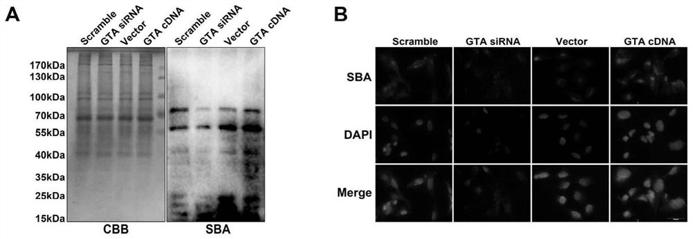 Biomarker for predicting preeclampsia and application thereof