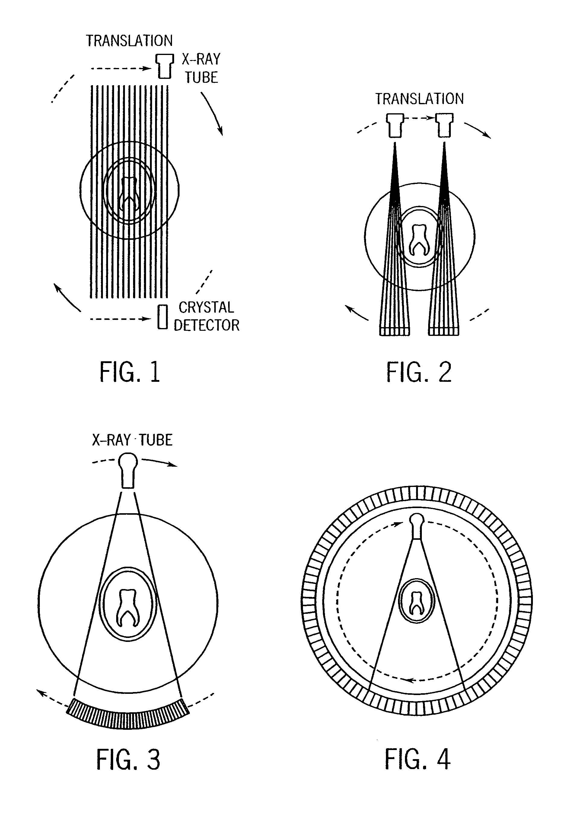 Cone-beam filtered backprojection image reconstruction method for short trajectories