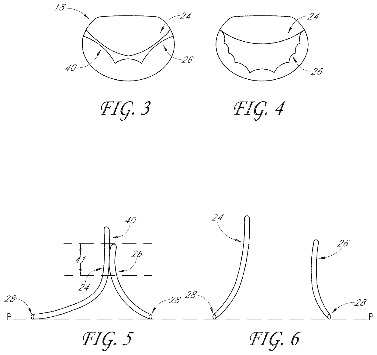 Percutaneous delivery systems for anchoring an implant in a cardiac valve annulus