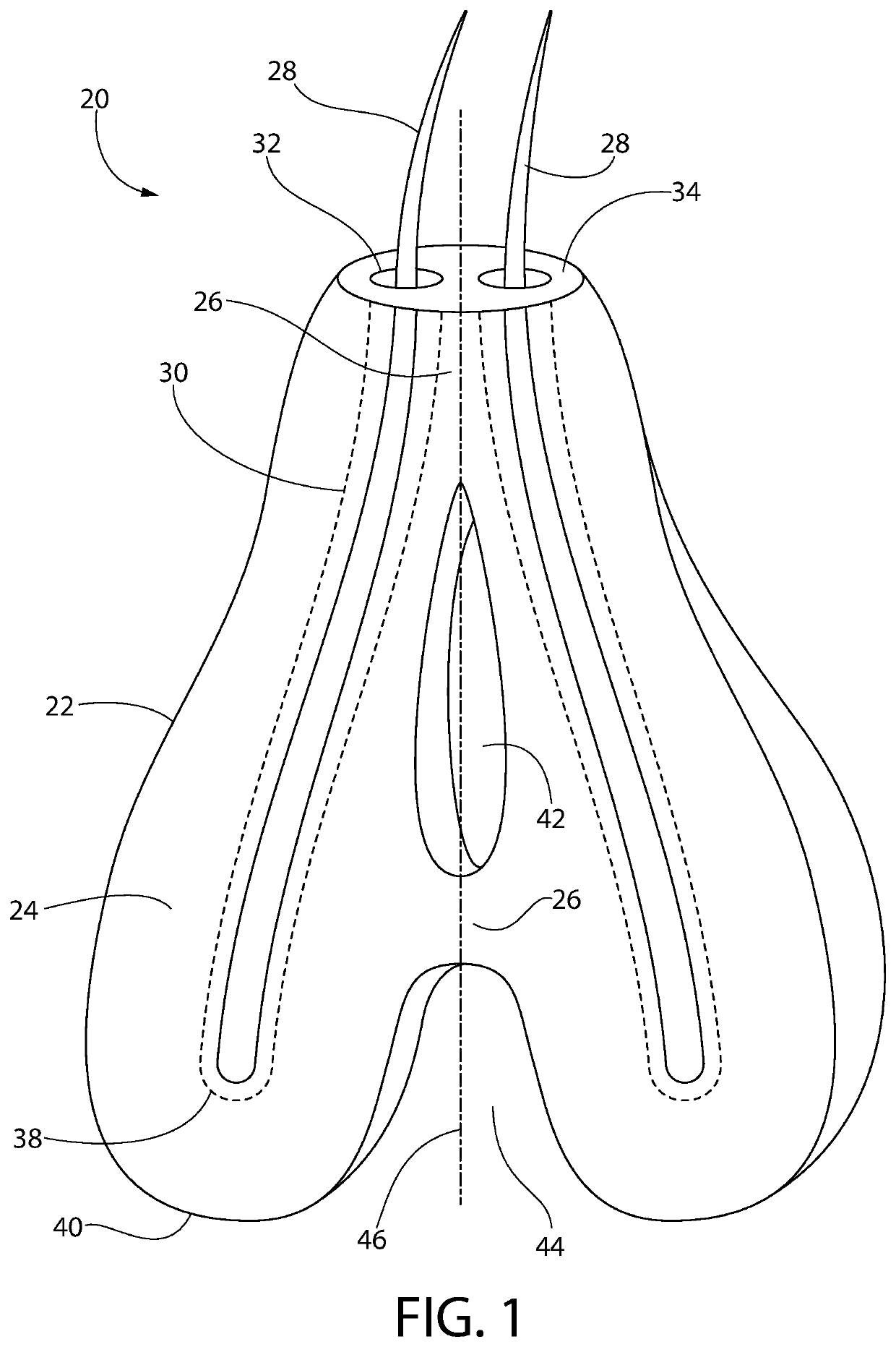 Hair implants comprising enhanced anchoring and medical safety features