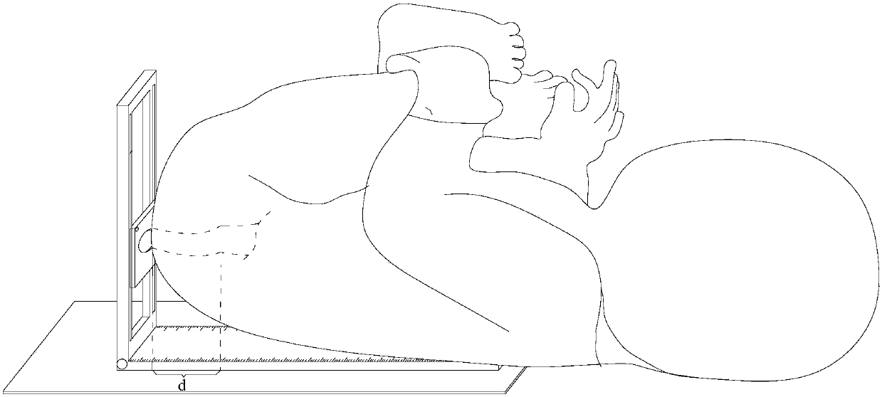 Three-dimensional measurement puncture ruler for infantile anal atresia