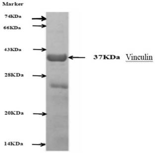 A kit for detecting anti-vinculin-igg antibody