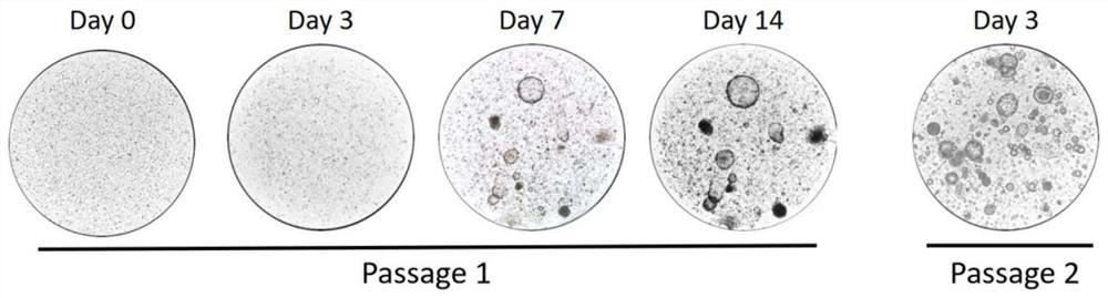 Cculture medium and culture method for ovarian cancer organoids