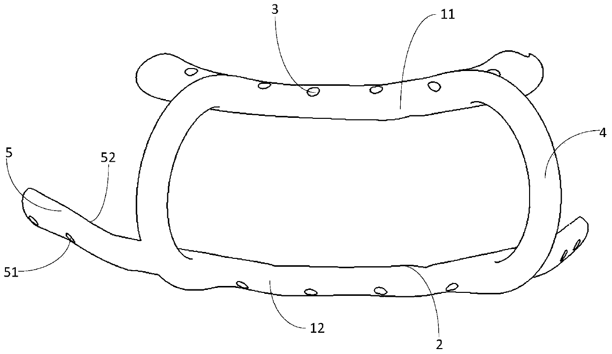 In-position guide plate applied to multi-segment fibula double-stack reconstruction of mandible