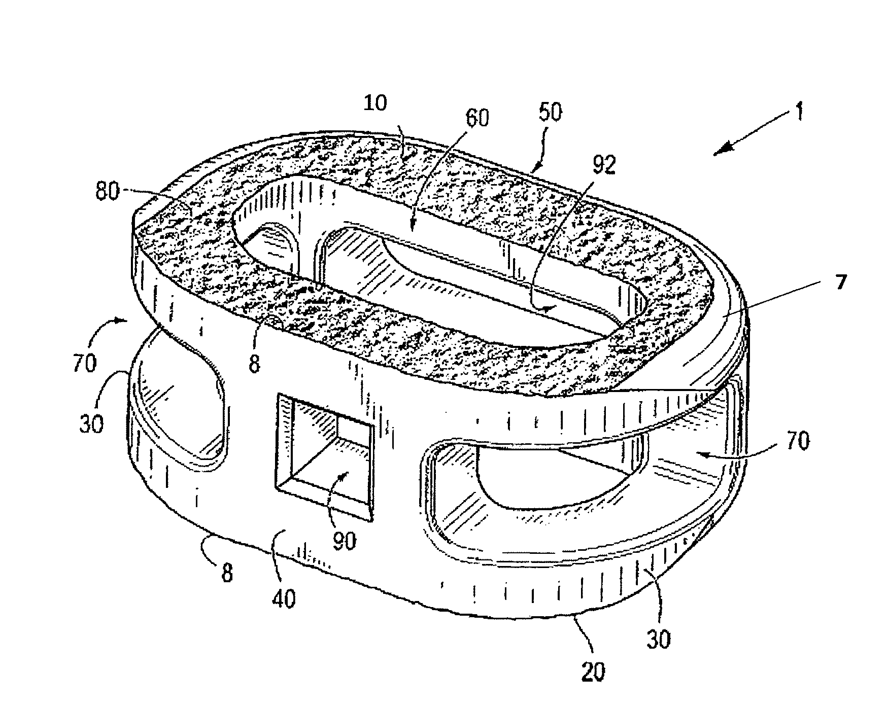 Methods for manufacturing implants having integration surfaces