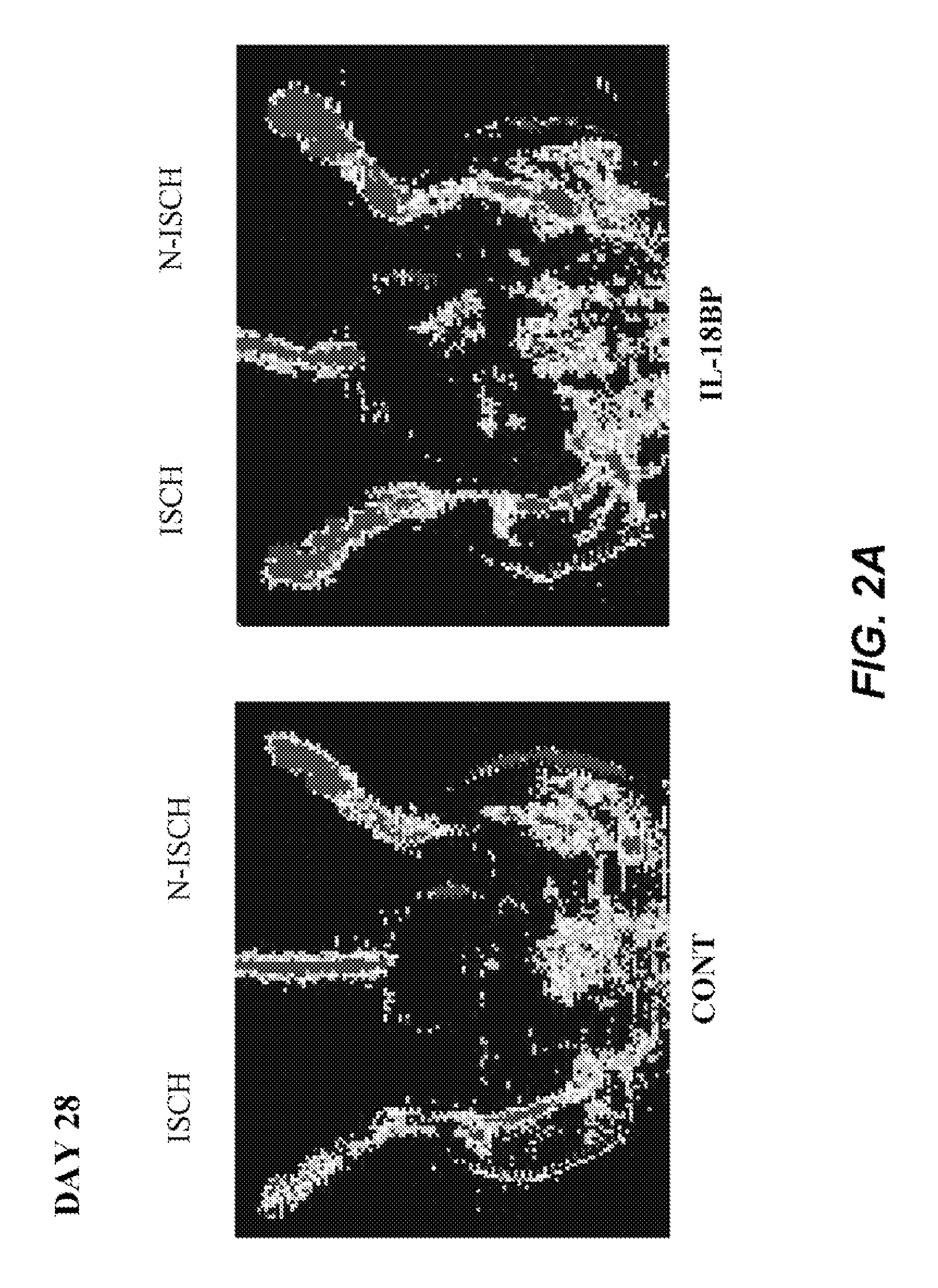 Method of treating peripheral vascular diseases using IL-18 inhibitors