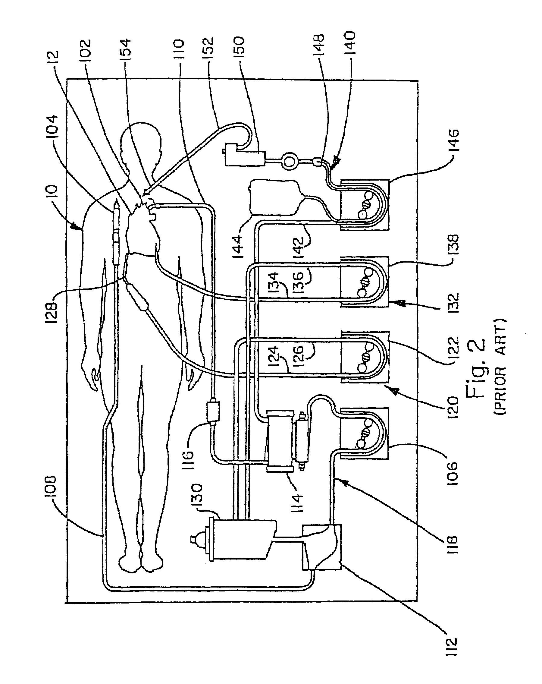 CPB system with fluid volume control